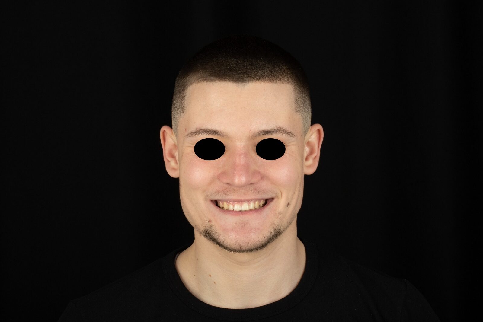 Muscatura corecta ortodontie caz stomatologic